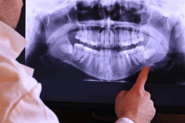 Best Urgent Dental Care for Toothache in Cloverly, MD