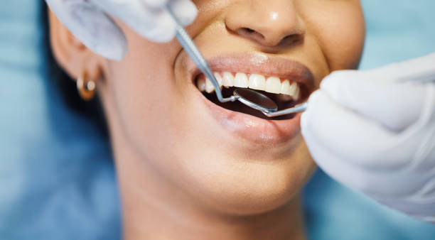 Best Holiday Emergency Dentist in Cloverly, MD