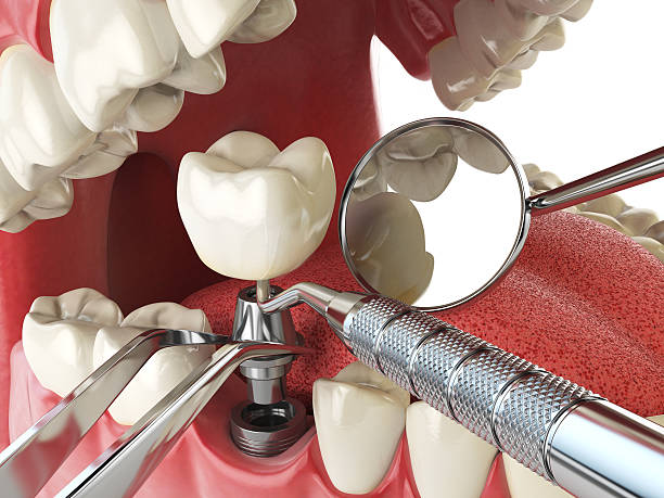 Best Mobile Emergency Dentist in Cloverly, MD